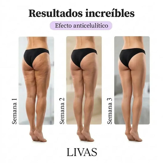 Leggings AntiCelulítis